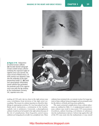 Basic radiology, 2nd ed.