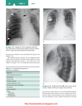 Basic radiology, 2nd ed.