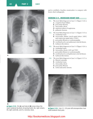 Basic radiology, 2nd ed.