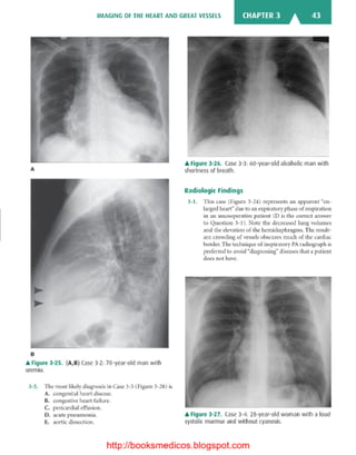 Basic radiology, 2nd ed.