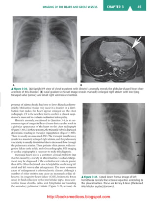 Basic radiology, 2nd ed.