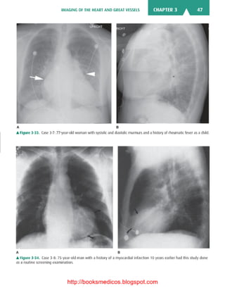 Basic radiology, 2nd ed.