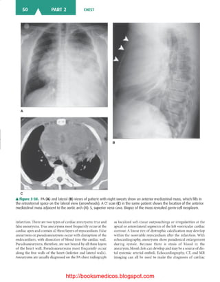 Basic radiology, 2nd ed.
