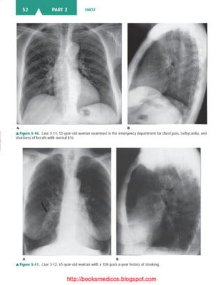 Basic radiology, 2nd ed.
