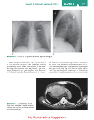 Basic radiology, 2nd ed.