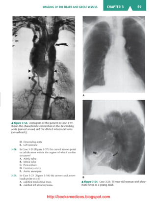 Basic radiology, 2nd ed.