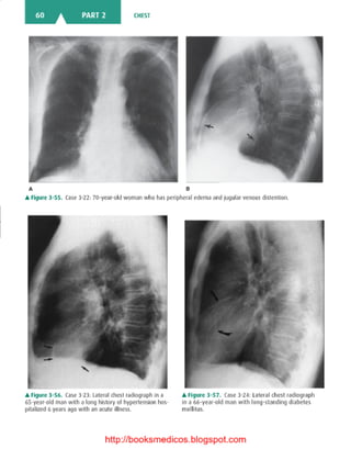 Basic radiology, 2nd ed.