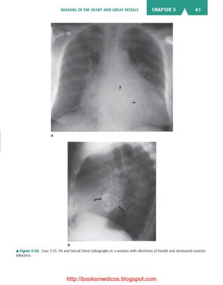 Basic radiology, 2nd ed.