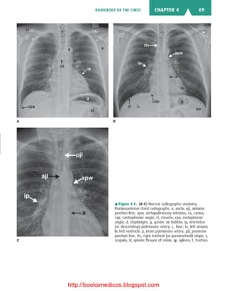 Basic radiology, 2nd ed.