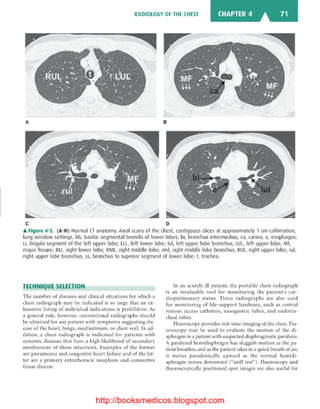 Basic radiology, 2nd ed.