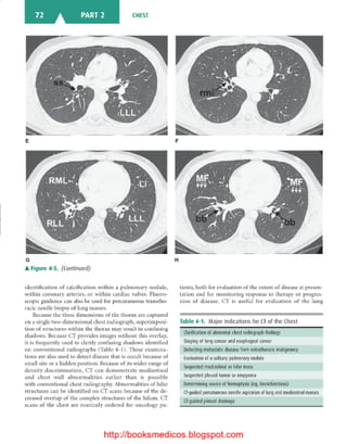Basic radiology, 2nd ed.