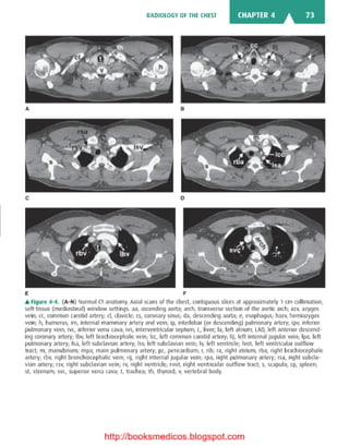 Basic radiology, 2nd ed.