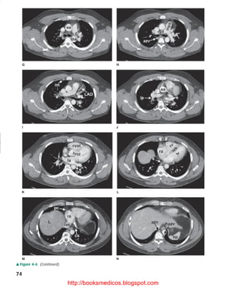 Basic radiology, 2nd ed.
