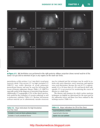 Basic radiology, 2nd ed.