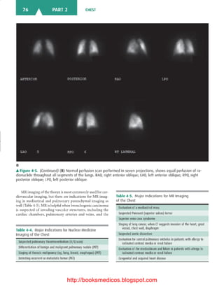 Basic radiology, 2nd ed.