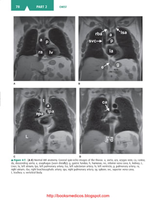 Basic radiology, 2nd ed.