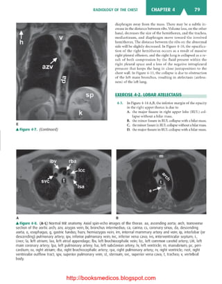 Basic radiology, 2nd ed.