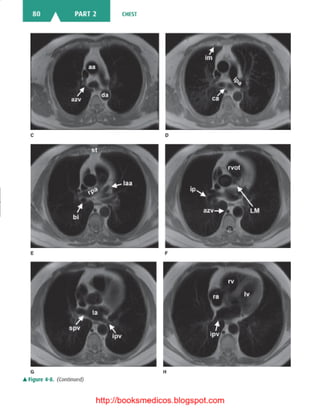 Basic radiology, 2nd ed.