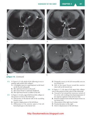 Basic radiology, 2nd ed.