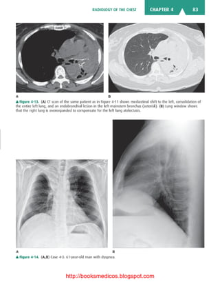 Basic radiology, 2nd ed.