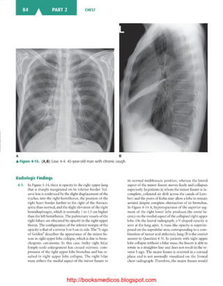 Basic radiology, 2nd ed.