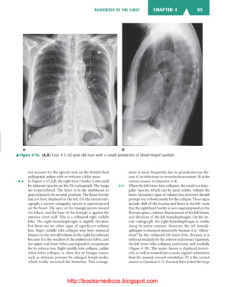 Basic radiology, 2nd ed.