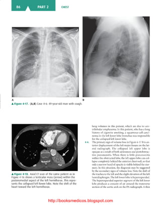 Basic radiology, 2nd ed.