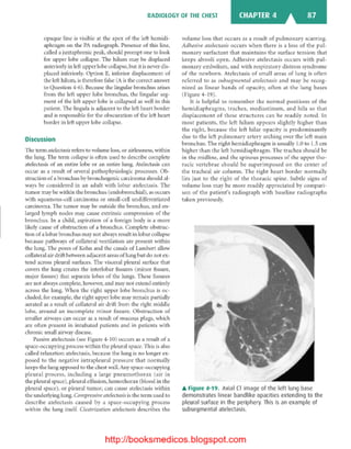 Basic radiology, 2nd ed.