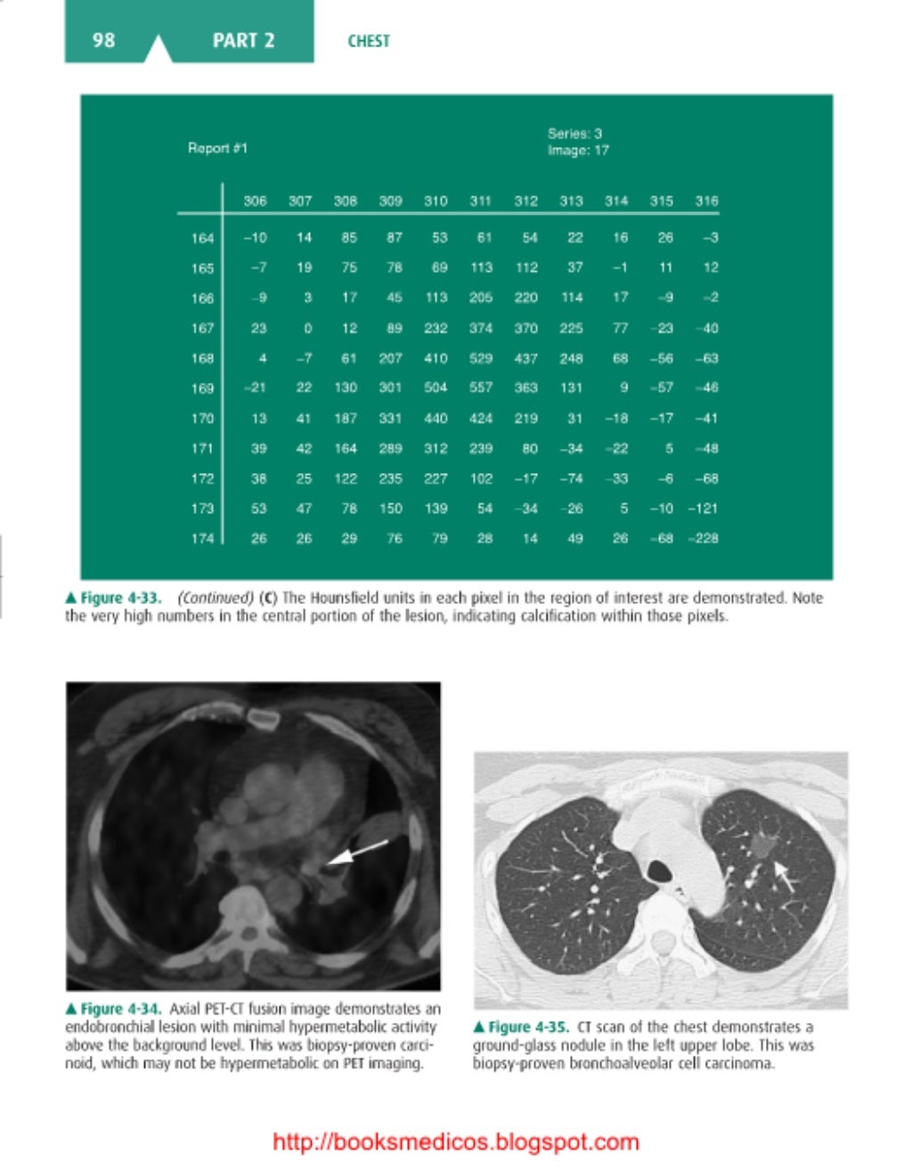 Basic radiology, 2nd ed.