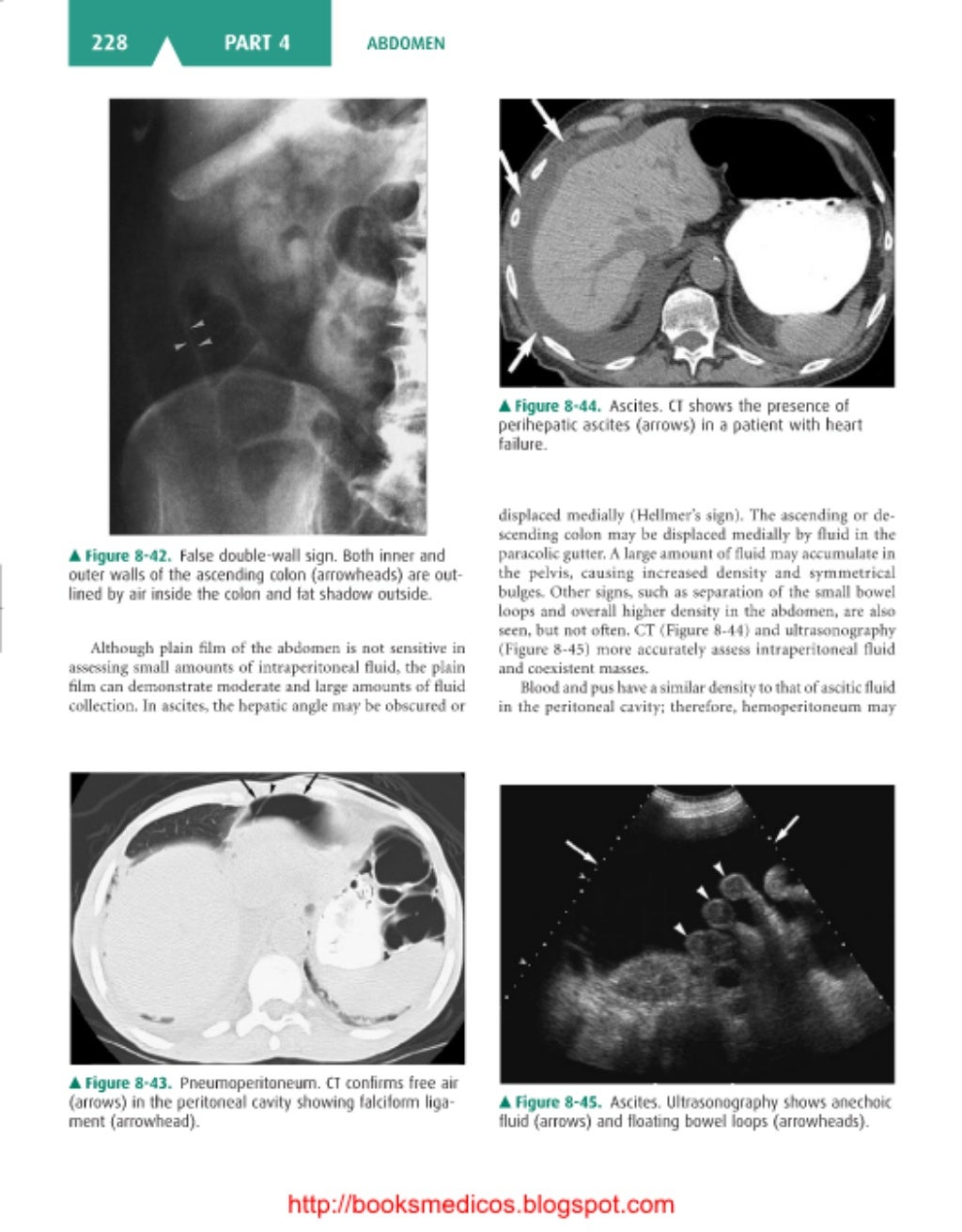 Basic radiology, 2nd ed.