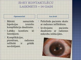 Optometristi Acu ārsti
 Būtiski samazinās
hipoksijas izraisīto
komplikāciju daudzums.
 Labāks komforts kl
lietotājiem.
 Komplikācijas,
piemēram, radzenes
infiltrāti ir grūtāk
novērtējami.
 Palielinās pacientu skaits
ar radzenes infiltrātiem.
 Ievērojams pacientu
daudzums ar radzenes
mikrobu infekcijām.
 