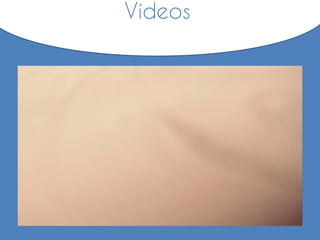Vídeos
 