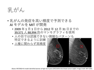 乳がん
• 乳がんの発症を高い精度で予測できる
AI モデルを MIT が開発
• 2009 年 1 月 1 日から 2012 年 12 月 31 日までの
39,571 人 88,994 件のマンモグラフィを使用
• 人の目では認識できない微細なパターンも
特定できるように訓練
• 人種に関わらず高精度
Above: MIT/MGH AI model identified woman at high risk 4 years (left) before her breast cancer (right):.Image Credit: MIT CSAIL
 