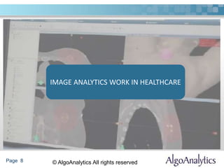 Page 8 © AlgoAnalytics All rights reserved
IMAGE ANALYTICS WORK IN HEALTHCARE
 
