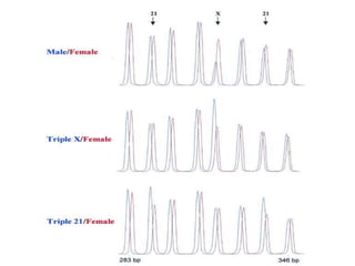 Mlpa (Multipleks PCR)