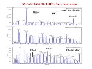 ERBB2
ERBB2
NeuroD2
SALSA MLPA kit P004 ERBB2 – Breast tumor samples
ERBB2 amplification
BRCA1 deletionBRCA1
BRCA1
 