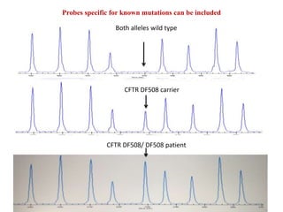 Probes specific for known mutations can be included
CFTR DF508 carrier
Both alleles wild type
CFTR DF508/ DF508 patient
 