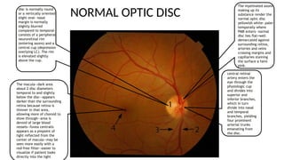 THE OPTIC NERVE ANATOMY AND PAPILLEDEMA.pptx