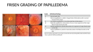 THE OPTIC NERVE ANATOMY AND PAPILLEDEMA.pptx