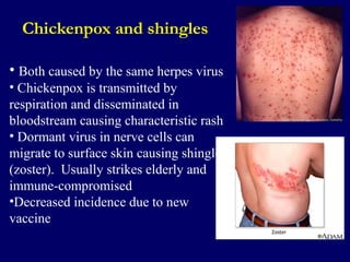 Air Microbiology | PPT