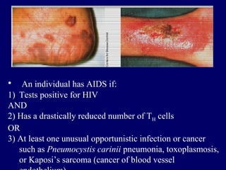 • An individual has AIDS if:
1) Tests positive for HIV
AND
2) Has a drastically reduced number of TH cells
OR
3) At least ...