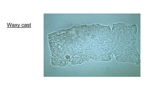 Urine: Microscopic examination - Pathology - MLT, ATOT, RDT | PPTX ...