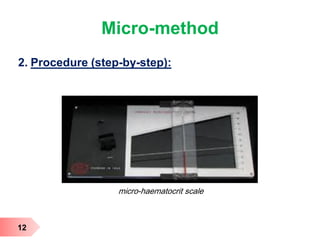 Micro-method
2. Procedure (step-by-step):
12
micro-haematocrit scale
 