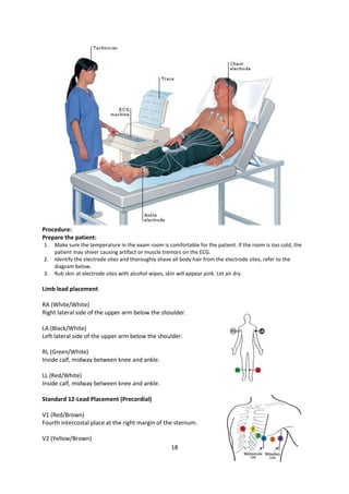 18
Procedure:
Prepare the patient:
1. Make sure the temperature in the exam room is comfortable for the patient. If the room is too cold, the
patient may shiver causing artifact or muscle tremors on the ECG.
2. Identify the electrode sites and thoroughly shave all body hair from the electrode sites, refer to the
diagram below.
3. Rub skin at electrode sites with alcohol wipes, skin will appear pink. Let air dry.
Limb lead placement
RA (White/White)
Right lateral side of the upper arm below the shoulder.
LA (Black/White)
Left lateral side of the upper arm below the shoulder.
RL (Green/White)
Inside calf, midway between knee and ankle.
LL (Red/White)
Inside calf, midway between knee and ankle.
Standard 12-Lead Placement (Precordial)
V1 (Red/Brown)
Fourth intercostal place at the right margin of the sternum.
V2 (Yellow/Brown)
 