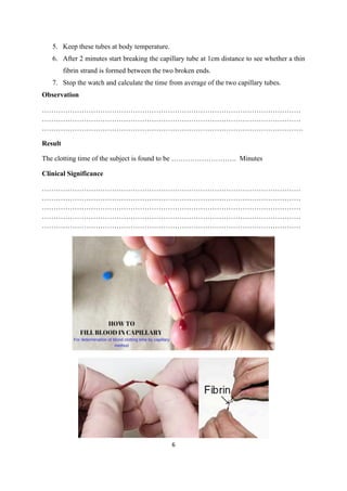 6
5. Keep these tubes at body temperature.
6. After 2 minutes start breaking the capillary tube at 1cm distance to see whether a thin
fibrin strand is formed between the two broken ends.
7. Stop the watch and calculate the time from average of the two capillary tubes.
Observation
…………………………………………………………………………………………………
…………………………………………………………………………………………………
………………………………………………………………………………………………….
Result
The clotting time of the subject is found to be ………………………. Minutes
Clinical Significance
…………………………………………………………………………………………………
…………………………………………………………………………………………………
…………………………………………………………………………………………………
…………………………………………………………………………………………………
…………………………………………………………………………………………………
 