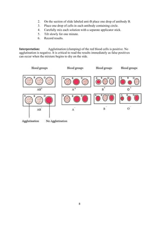 8
2. On the section of slide labeled anti-B place one drop of antibody B.
3. Place one drop of cells in each antibody containing circle.
4. Carefully mix each solution with a separate applicator stick.
5. Tilt slowly for one minute.
6. Record results.
Interpretation: Agglutination (clumping) of the red blood cells is positive. No
agglutination is negative. It is critical to read the results immediately as false positives
can occur when the mixture begins to dry on the side.
 