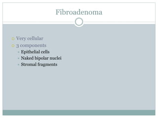 Fibroadenoma
 Very cellular
 3 components
 Epithelial cells
 Naked bipolar nuclei
 Stromal fragments
 