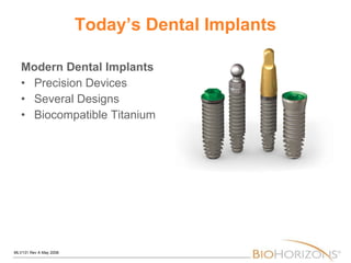 Today’s Dental Implants Modern Dental Implants Precision Devices Several Designs Biocompatible Titanium 