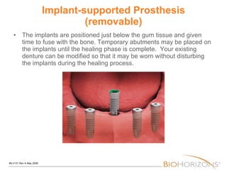 Implant-supported Prosthesis (removable) The implants are positioned just below the gum tissue and given time to fuse with the bone. Temporary abutments may be placed on the implants until the healing phase is complete.  Your existing denture can be modified so that it may be worn without disturbing the implants during the healing process. 