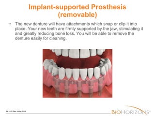 Implant-supported Prosthesis (removable) The new denture will have attachments which snap or clip it into place. Your new teeth are firmly supported by the jaw, stimulating it and greatly reducing bone loss. You will be able to remove the denture easily for cleaning. 